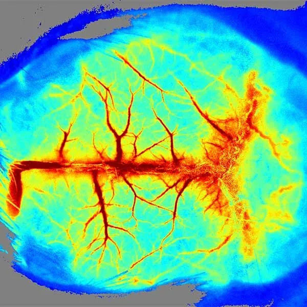 RWD RFLSI-ZW Laser Speckle Contrast Imaging System