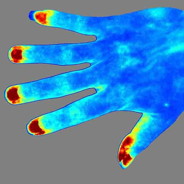 RWD RFLSI-ZW Laser Speckle Contrast Imaging System